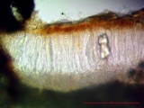 Sarcogyne privigna image