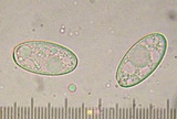 Sarcosphaera coronaria image