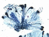 Catillaria chalybeia image
