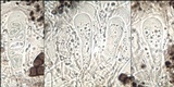 Buellia subdisciformis image