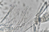 Lachnum subvirgineum image