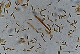Lachnum subvirgineum image