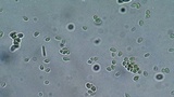 Clonostachys rosea image