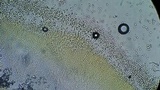 Clonostachys rosea image