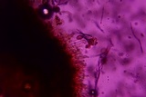 Melanconium stromaticum image
