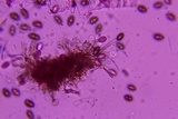 Melanconium stromaticum image