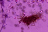 Melanconium stromaticum image