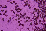 Melanconium stromaticum image