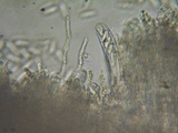 Cudoniella clavus image
