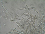 Cudoniella clavus image