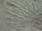 Cudoniella clavus image