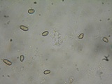 Inocybe amblyospora image