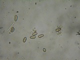 Inocybe amblyospora image