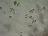 Nolanea holoconiota image