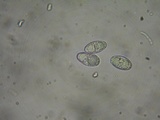 Tarzetta cupularis image