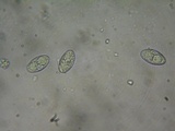 Tarzetta cupularis image