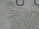 Tarzetta cupularis image
