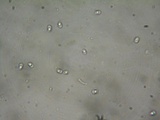 Schizopora paradoxa image