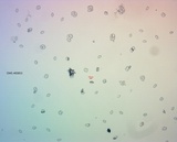 Plectania milleri image