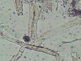 Hydnophlebia chrysorhiza image