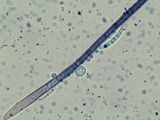 Menispora cobaltina image