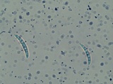 Menispora cobaltina image
