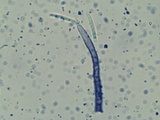 Menispora cobaltina image