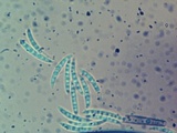 Menispora cobaltina image