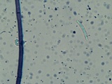 Menispora cobaltina image