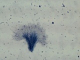 Dendrostilbella smaragdina image