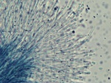 Dendrostilbella smaragdina image