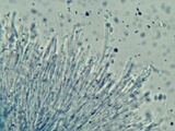 Dendrostilbella smaragdina image