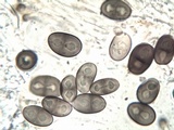 Rinodina atrocinerea image