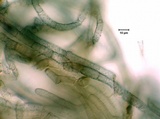 Tylopilus cyanogranulifer image
