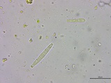 Lasiosphaeria ovina image