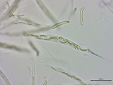 Lasiosphaeria ovina image