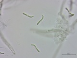 Lasiosphaeria ovina image