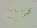 Lasiosphaeria ovina image