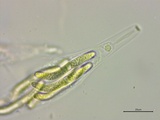 Lasiosphaeria ovina image