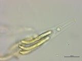 Lasiosphaeria ovina image