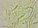 Lasiosphaeria ovina image