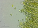 Peziza waltersii image