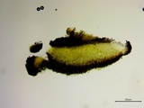 Patellaria atrata image