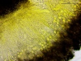 Patellaria atrata image