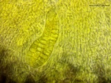 Patellaria atrata image