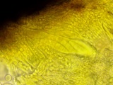 Patellaria atrata image
