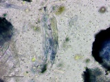 Patellaria atrata image