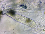 Patellaria atrata image