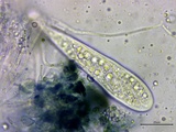 Patellaria atrata image