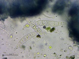 Patellaria atrata image